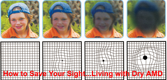 How to Save Your Sight